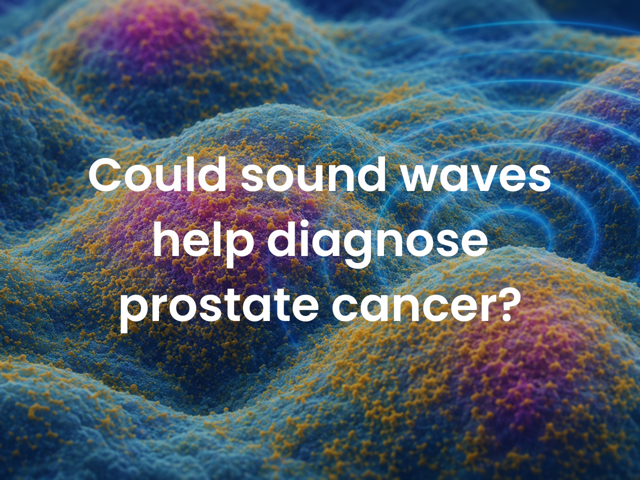 Could sound waves help diagnose prostate cancer? 